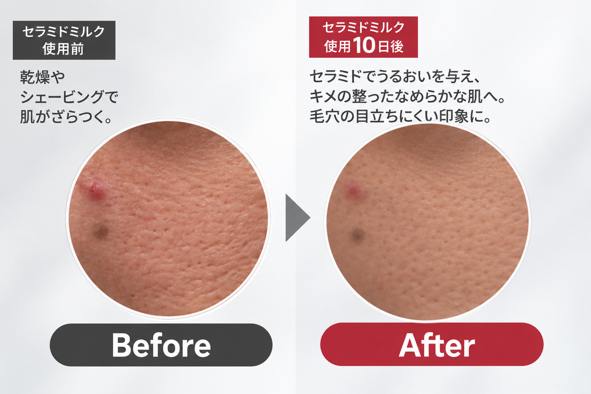 DOROSCRUB セラミドMILK｜使用前と使用10日後の肌の状態を比較したビフォーアフター画像